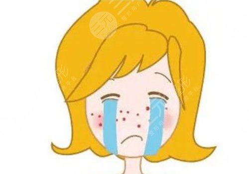 祛痘印痘坑好的方法