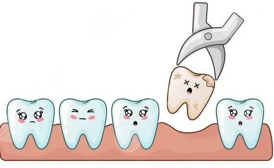 拔了智齒后的護(hù)理
