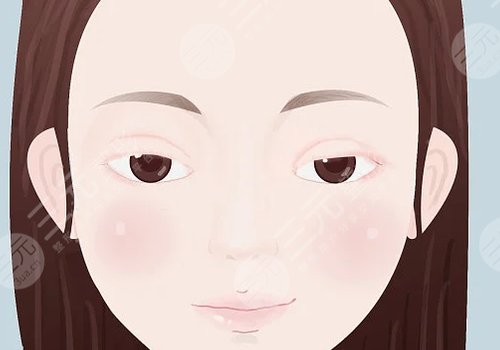 上瞼下垂矯正手術(shù)有風(fēng)險(xiǎn)嗎？