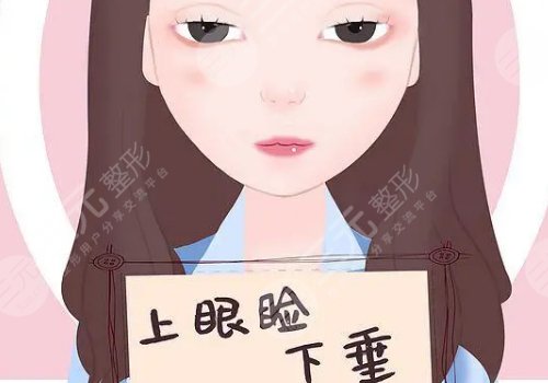 上瞼下垂矯正大概需要多少費(fèi)用？