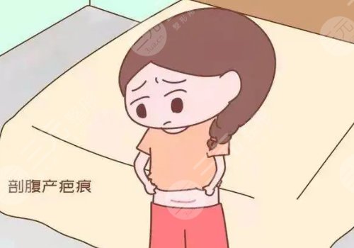 激光去疤痕需要幾次才能徹底消除？