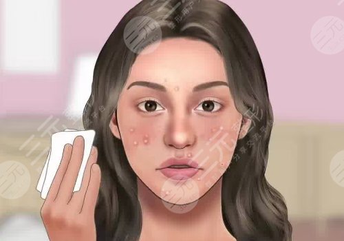 去黑頭收縮毛孔好的方法有哪些？