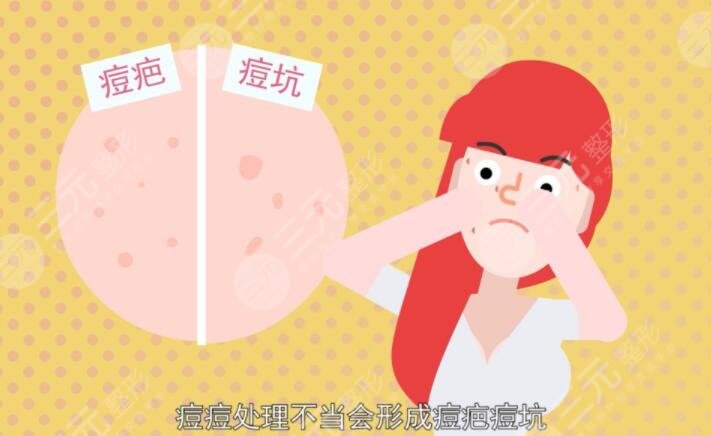 怎么樣祛痘疤效果好?