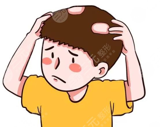 　　斑禿能治好嗎?斑禿這個(gè)情況是能夠很好的解決的，如果和愛(ài)美者情況不是特別嚴(yán)重的話，可以采用一些藥物來(lái)進(jìn)行改良，如果情況比較嚴(yán)重，則可以進(jìn)行手術(shù)，選擇一家正規(guī)的機(jī)構(gòu)面診，確定手術(shù)方案之后進(jìn)行手術(shù)，能夠很好的解決斑禿這一方面的問(wèn)題，特別是采用激光祛斑這個(gè)手術(shù)方法，一般來(lái)說(shuō)是是能夠很好的給愛(ài)美者帶來(lái)改良的。  　　一、斑禿能治好嗎?  　　斑禿這個(gè)情況是可以治好的，主要的話，出現(xiàn)這樣的情況是采用藥物緩解的，但是如果病情比較輕的愛(ài)美者可以進(jìn)行自行恢復(fù)，但是這樣子的話，病情容易反復(fù)，想要治根的話是比較難的。  　　出現(xiàn)斑禿的情況是斑塊脫落發(fā)生的病變，具體的原因的話，很可能和愛(ài)美者自身免疫或者是遺傳的情況出現(xiàn)，相關(guān)因素是比較多的，需要進(jìn)行緩解的話，愛(ài)美者要在正規(guī)的機(jī)構(gòu)面診，確定之后才能夠順利的進(jìn)行手術(shù)。  　　想要很好的緩解斑禿的話，可以采用局部涂抹米諾地爾藥物來(lái)進(jìn)行，因?yàn)檫@個(gè)藥物能夠很好的緩解毛發(fā)癥狀，同時(shí)愛(ài)美者也可以服用一些維生素B的藥物。對(duì)于一些病情比較輕的愛(ài)美者來(lái)說(shuō)，可以根據(jù)醫(yī)生的見(jiàn)解多吃一些藥物來(lái)進(jìn)行緩解，在一段時(shí)間之后就可以很好的恢復(fù)了。  　　二、斑禿是怎么引起的?  　　1、氣血不足  　　氣血不足一般身體的抵抗力不是特別的好，所以說(shuō)是比較容易有患上斑禿這一種疾病的，因?yàn)闅庋蛔阌绊戭^皮的健康，容易導(dǎo)致頭發(fā)大量脫落，然后形成斑禿。  　　2、肝腎虧虛  　　肝腎虧虛時(shí)，容易引起這樣的情況發(fā)生，因?yàn)闀?huì)導(dǎo)致氣血不足，頭發(fā)沒(méi)有辦法獲得分的營(yíng)養(yǎng)，從而導(dǎo)致斑禿的情況出現(xiàn)，如果不能得到解決的話，斑禿會(huì)越來(lái)越嚴(yán)重，需要愛(ài)美者進(jìn)行調(diào)理之后才能恢復(fù)。  　　3、自身免疫  　　如果愛(ài)美者的自身免疫利益相對(duì)來(lái)說(shuō)比較低的話，會(huì)發(fā)生這樣的情況，因?yàn)樽陨砻庖吡Φ停瑫?huì)損害毛囊的健康，導(dǎo)致頭發(fā)生長(zhǎng)減慢，斑禿的幾率會(huì)大一些。  　　4、過(guò)敏因素  　　如果愛(ài)美者的頭皮發(fā)生了過(guò)敏反應(yīng)的話，會(huì)容易引起頭皮瘙癢等等，這些癥狀就是容易導(dǎo)致斑禿的現(xiàn)象。如果愛(ài)美者有過(guò)敏的情況出現(xiàn)的話，一定要及時(shí)去處理，才能夠預(yù)防斑禿的情況出現(xiàn)。  　　三、斑禿可以自愈嗎?  　　絕大多數(shù)斑禿是可以自愈的，因?yàn)榘叨d的話是一種自限性的皮膚病，的話相對(duì)來(lái)說(shuō)是比較簡(jiǎn)單的，但是的話是要根據(jù)每一位愛(ài)美者的不同情況來(lái)進(jìn)行決定的，如果是由于疾病引起的斑禿是無(wú)法自愈的，需要進(jìn)行手術(shù)來(lái)解決這個(gè)情況。  　　斑禿是一種突發(fā)性的癥狀，這種癥狀的表現(xiàn)就是頭發(fā)有部分脫落的情況，情況大小不一，數(shù)目不等。