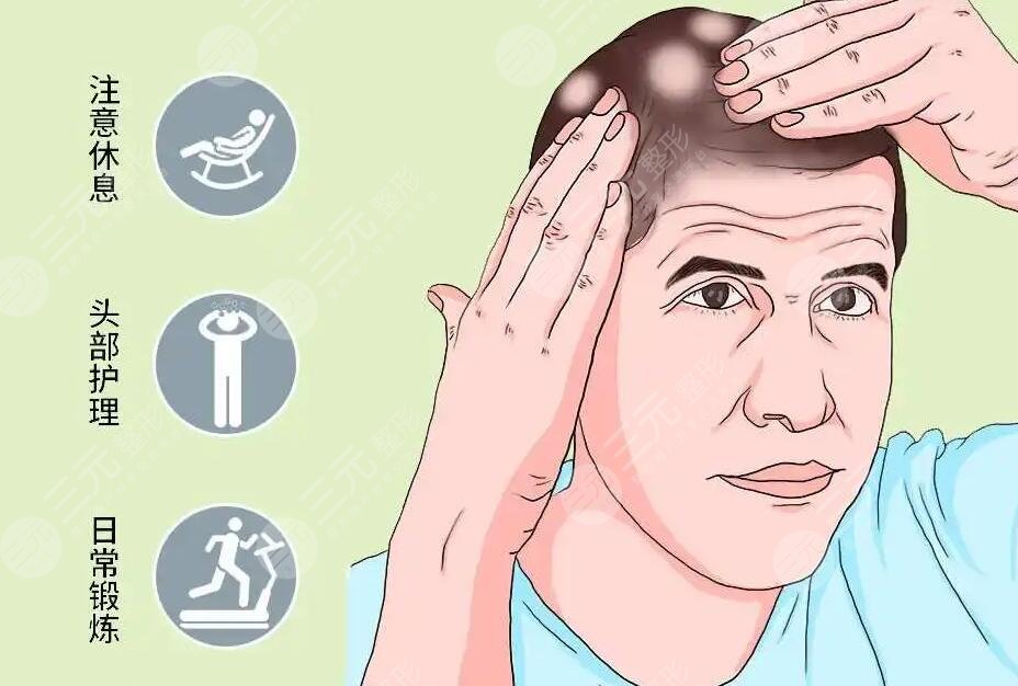 斑禿是怎么引起的?