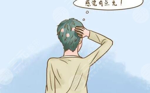 斑禿是怎么引起的?