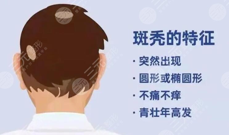 斑禿可以自愈嗎?