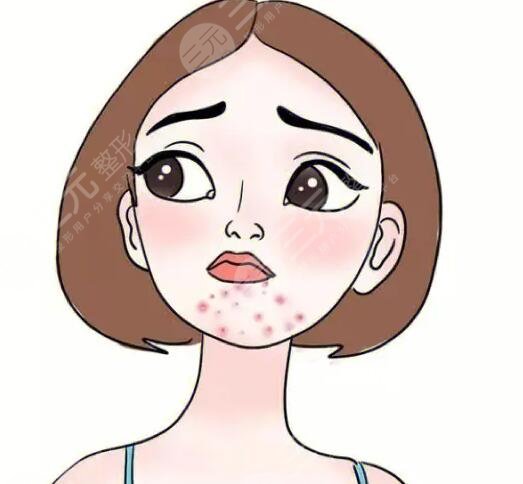 　　很多人經(jīng)常在下巴處會(huì)長(zhǎng)一些痘痘，有的人認(rèn)為長(zhǎng)痘痘的原因是和自己的內(nèi)分泌有關(guān)系，也有的女性朋友認(rèn)為自己的長(zhǎng)痘問(wèn)題和自己的護(hù)膚存在一定的關(guān)系，所以說(shuō)在面對(duì)自己的痘痘時(shí)，一定要充分地了解自己長(zhǎng)痘的類(lèi)型，這樣才能夠改良痘痘使痘痘消除，所以說(shuō)想豆豆和我們的身體健康存在一定關(guān)系的，大家不但要調(diào)整自己的作息習(xí)慣，同時(shí)也要有正確的護(hù)膚流程，一起來(lái)了解下吧，長(zhǎng)痘的是哪里的問(wèn)題?  　　下巴長(zhǎng)痘痘是哪里的問(wèn)題?  　　1、飲食問(wèn)題  　　下巴長(zhǎng)痘痘根據(jù)飲食有著一定的關(guān)系，所以說(shuō)如果我們長(zhǎng)期飲食不規(guī)律，在體內(nèi)的毒素長(zhǎng)期積累，從而會(huì)影響我們的皮膚狀態(tài)產(chǎn)生一些皮膚問(wèn)題，例如長(zhǎng)痘痘長(zhǎng)色斑等，建議大家在飲食方面堅(jiān)持以清淡健康的飲食為主，也要少吃一些辛辣刺激性的食物，這樣才可以很好地改良肌膚，也要養(yǎng)成良好的作息習(xí)慣，可以早睡早起經(jīng)常參加一些鍛煉，也能夠減少痘痘的產(chǎn)生，同時(shí)也要戒煙戒酒，把這些壞習(xí)慣都改掉之后，配合飲食配合作息，就可以改良痘痘。  　　2、激素失衡問(wèn)題  　　有一些人群下巴長(zhǎng)痘痘的原因和自己體內(nèi)激素分泌有一定的關(guān)系，所以說(shuō)如果激素失衡，也會(huì)在下巴處長(zhǎng)一些痘痘，比如說(shuō)女性朋友在來(lái)月經(jīng)之前，身體內(nèi)的激素會(huì)處于一個(gè)不平衡的狀態(tài)，會(huì)間接引起皮脂腺分泌旺盛，從而在下巴處長(zhǎng)出一些痘痘，如果是這種情況，建議大家一定要放松心情，從而改良睡眠質(zhì)量，減輕壓力，才可以很好地度過(guò)這個(gè)時(shí)期，但是這種痘痘往往在月經(jīng)過(guò)后就會(huì)恢復(fù)到一個(gè)正常的皮膚狀態(tài)，不用過(guò)分的擔(dān)心。  　　3、內(nèi)分泌失調(diào)  　　內(nèi)分泌失調(diào)也會(huì)導(dǎo)致痘痘的產(chǎn)生，所以說(shuō)在失調(diào)的過(guò)程當(dāng)中會(huì)使皮脂腺分泌得過(guò)于旺盛，由于油脂分泌的較多，不能夠及時(shí)清潔，很容易堵塞毛孔，產(chǎn)生一些油膩的痘痘，這時(shí)候一定要調(diào)節(jié)自己的內(nèi)分泌，改良自己的睡眠，才可以改良痘痘，也可以服用一些中藥來(lái)進(jìn)行改良。  　　4、體內(nèi)毒素堆積過(guò)多  　　如果我們經(jīng)常吃一些比較油膩的食物，會(huì)引起消化方面的問(wèn)題，所以說(shuō)在體內(nèi)會(huì)堆積過(guò)多的毒素，從而使毒素沒(méi)有辦法排出，導(dǎo)致痘痘的產(chǎn)生，如果是體內(nèi)毒素堆積過(guò)多，首先長(zhǎng)痘的部位就是下巴處，這時(shí)候人們的肝臟排毒功能也逐漸下降，一定要積極地調(diào)整飲食，健康的作息才可以得到根本的改變，這時(shí)候可以吃一些比較常見(jiàn)的排毒養(yǎng)顏膠囊，也可以在專(zhuān)業(yè)的醫(yī)生指導(dǎo)下吃一些中藥。  　　5、青春痘  　　很多人在青春期的時(shí)候會(huì)長(zhǎng)一些痘痘，這么也是大家所說(shuō)的，青春痘在長(zhǎng)痘的過(guò)程當(dāng)中還會(huì)伴隨局部疼痛紅腫等問(wèn)題，一定要積極地尋找醫(yī)生的緩解，可以選用激光緩解痘痘。