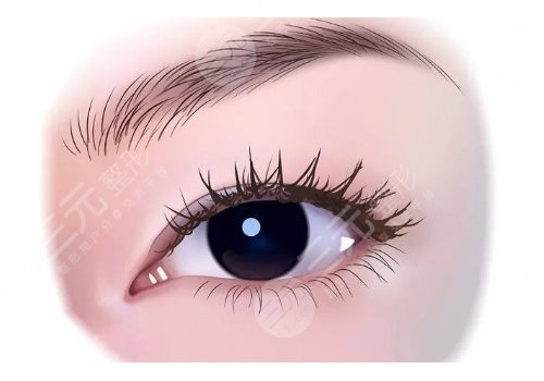 眼部整形有哪些項(xiàng)目？