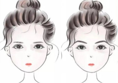 填充太陽(yáng)凹陷脂肪能保持多久?