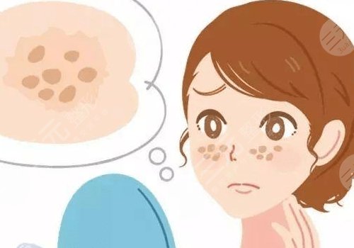 激光祛斑會不會反彈？需要做幾次？