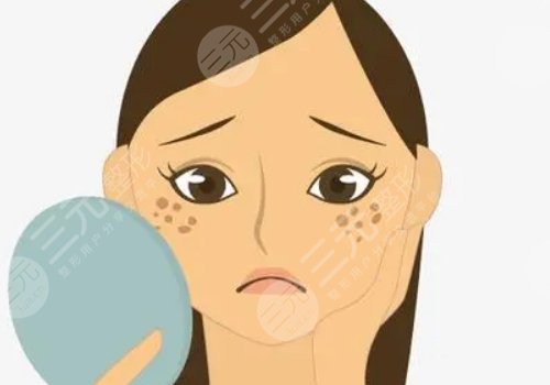 激光祛斑會不會反彈？需要做幾次？