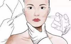 如何去川字紋？分析5種不同方案，除皺術前掃盲小課堂！