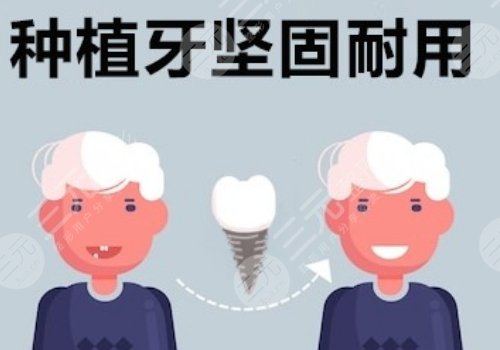 種植牙瑞士瑞典哪個(gè)好？