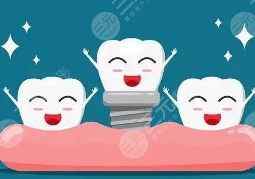 種植牙瑞士瑞典哪個(gè)好？