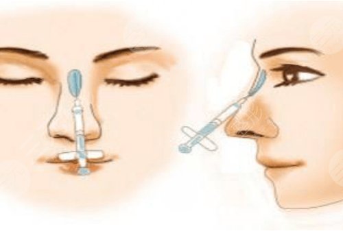 艾莉薇傳奇玻尿酸維持多久？