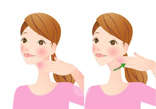 艾莉薇傳奇玻尿酸維持多久？