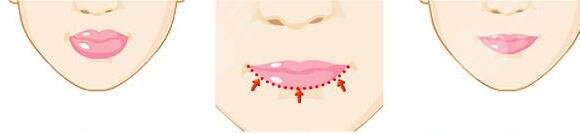 其他美唇小妙招