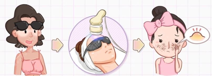 激光嫩膚適用人群