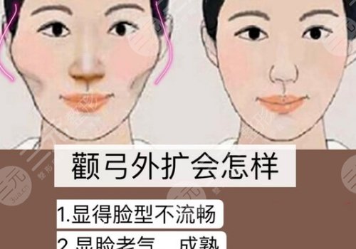 杭州時(shí)光陳小平顴骨下顎骨技術(shù)怎么樣？