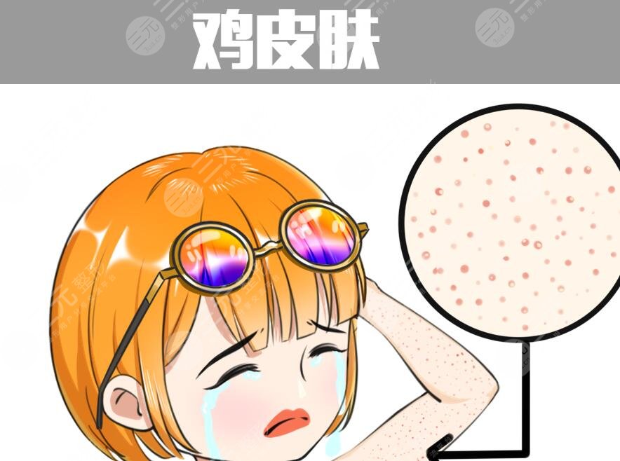 雞皮疙瘩皮膚怎么治見效快？預(yù)防和根治雙重入手，避免反復(fù)發(fā)作！