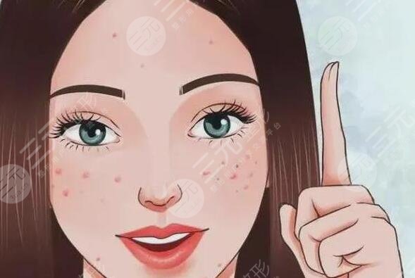 緩解青春痘費(fèi)用大概多少錢？哪些方法有效且安全可靠？