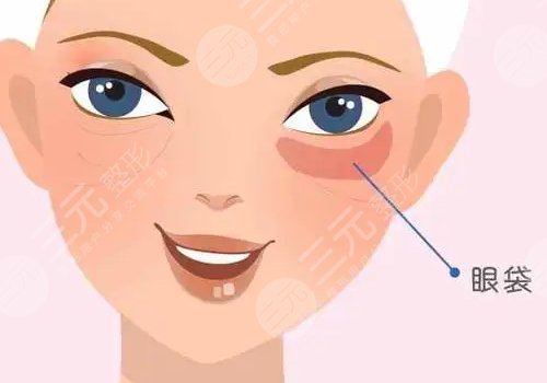 眼袋怎么消除？