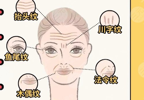 7d聚拉提美容的功效和副作用有哪些？