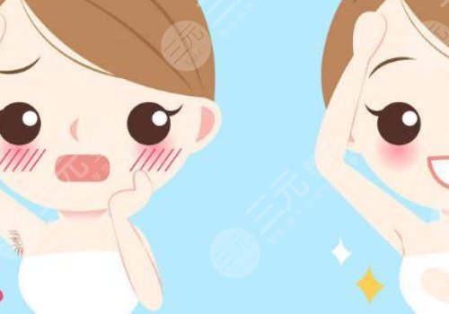 激光脫毛和冰點(diǎn)脫毛有什么區(qū)別？