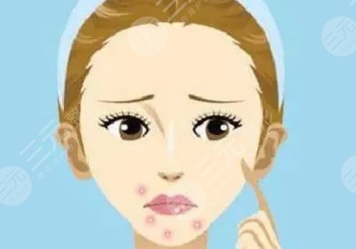 口周一直長痘痘什么原因？