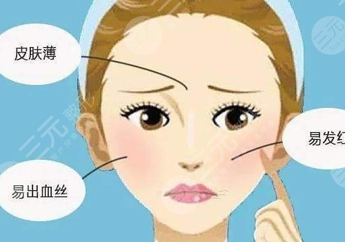 紅血絲皮膚用什么護膚品？3