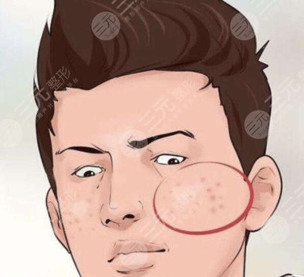 清潔皮膚是關(guān)鍵