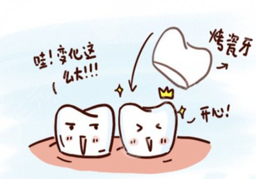 鈷鉻烤瓷牙套怎么樣？