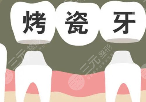 鈷鉻烤瓷牙套怎么樣？