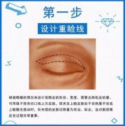 切開(kāi)雙眼皮過(guò)程圖解！術(shù)前必看掃盲小課堂！
