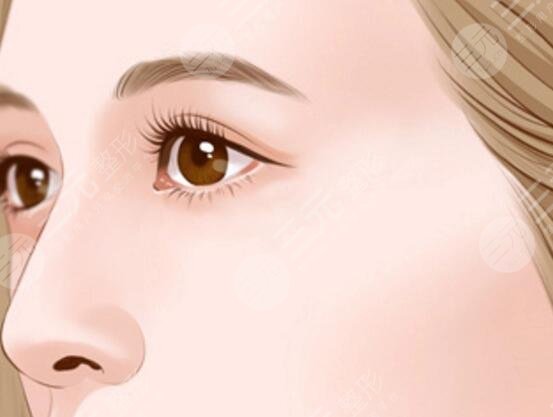 墊鼻梁有什么后遺癥嗎？手術伴隨的風險和副作用該怎么規(guī)避？