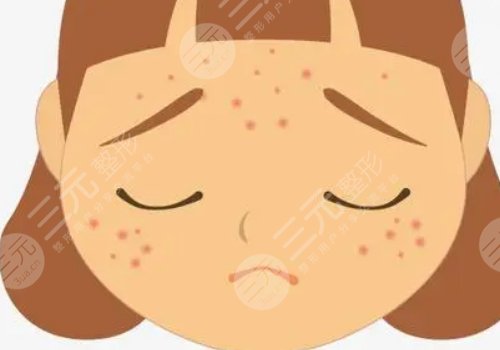 如何去除臉上的青春痘？