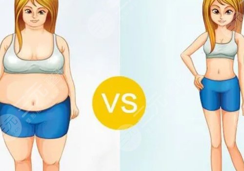 產(chǎn)后吸脂減肥好嗎？