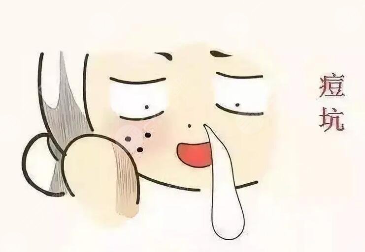 激光磨皮去痘印有效嗎？手術(shù)注意事項有哪些？哪些人適合做？