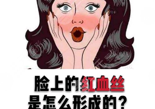 怎么減少紅血絲的產(chǎn)生？