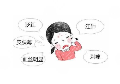 怎么減少紅血絲的產(chǎn)生?