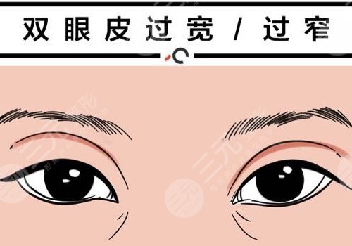 雙眼皮修復(fù)大概多少錢呢？