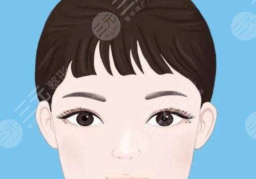 雙眼皮修復(fù)大概多少錢呢？
