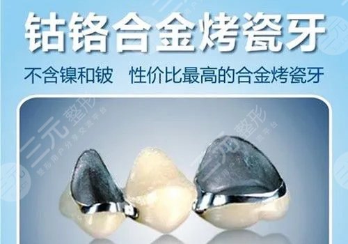 烤瓷牙多少錢一顆價(jià)格表2023