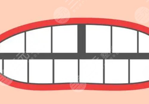 牙縫很大怎么辦?