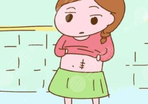 有傷疤怎么去掉？