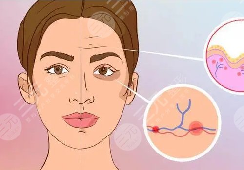 膚萊美和膚麗美的區(qū)別是什么？