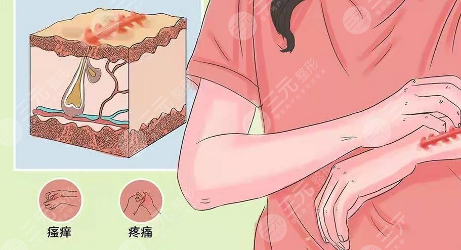 有傷疤怎么去掉？