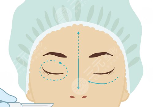 切雙眼皮多久能恢復(fù)自然？