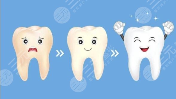 怎樣使牙齒變白還不傷牙齒的小妙招